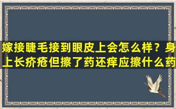 嫁接睫毛接到眼皮上会怎么样？身上长疥疮但擦了药还痒应擦什么药好得快