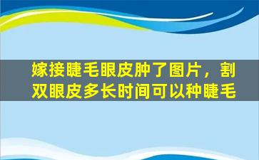 嫁接睫毛眼皮肿了图片，割双眼皮多长时间可以种睫毛